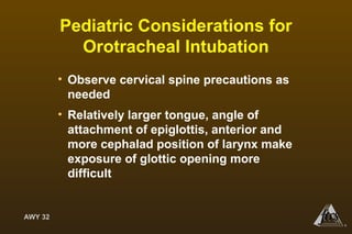 AWY 32
®
Pediatric Considerations for
Orotracheal Intubation
• Observe cervical spine precautions as
needed
• Relatively larger tongue, angle of
attachment of epiglottis, anterior and
more cephalad position of larynx make
exposure of glottic opening more
difficult
 