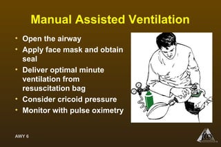 AWY 6
®
Manual Assisted Ventilation
• Open the airway
• Apply face mask and obtain
seal
• Deliver optimal minute
ventilation from
resuscitation bag
• Consider cricoid pressure
• Monitor with pulse oximetry
 