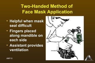 AWY 8
®
Two-Handed Method of
Face Mask Application
• Helpful when mask
seal difficult
• Fingers placed
along mandible on
each side
• Assistant provides
ventilation
 