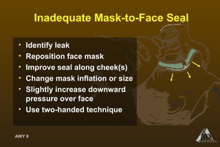 AWY 9
®
Inadequate Mask-to-Face Seal
• Identify leak
• Reposition face mask
• Improve seal along cheek(s)
• Change mask inflation or size
• Slightly increase downward
pressure over face
• Use two-handed technique
 