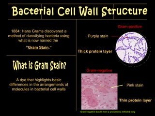 1884: Hans Grams discovered a method of classifying bacteria using what is now named the  “ Gram Stain .” What is Gram Stain? A dye that highlights basic differences in the arrangements of molecules in bacterial cell walls Bacterial Cell Wall Structure  Gram-negative bacilli  from  a pneumonia  infected  lu ng Gram-positive Purple stain Thick protein layer Gram-negative Pink stain Thin protein layer 