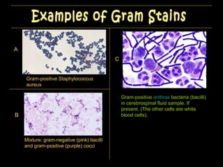 A B Examples of Gram Stains Gram-positive  anthrax  bacteria ( bacilli ) in  cerebrospinal fluid  sample. If present. (The other cells are  white blood cells ). Gram-positive Staphylococcus aureus Mixture:  gram-negative (pink) bacilli and gram-positive (purple) cocci C 
