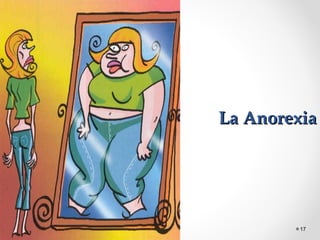 La AnorexiaLa Anorexia
17
 