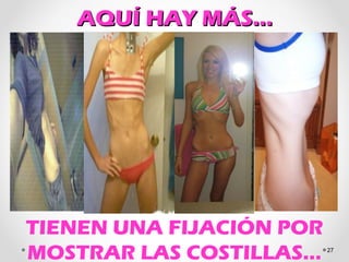 AQUÍ HAY MÁS…AQUÍ HAY MÁS…
27
TIENEN UNA FIJACIÓN POR
MOSTRAR LAS COSTILLAS…
 