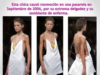 Esta chica causó conmoción en una pasarela enEsta chica causó conmoción en una pasarela en
Septiembre de 2006, por su extrema delgadez y suSeptiembre de 2006, por su extrema delgadez y su
semblante de enferma.semblante de enferma.
44
 