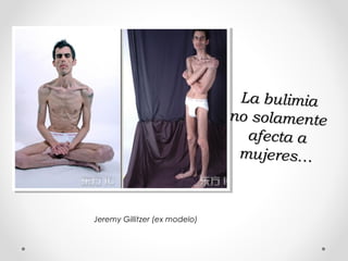 La bulimiaLa bulimia
no solamenteno solamente
afecta aafecta a
mujeres…mujeres…
Jeremy Gillitzer (ex modelo)
 