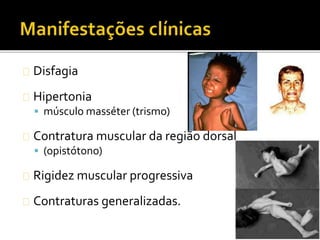 Disfagia
Hipertonia
 músculo masséter (trismo)
Contratura muscular da região dorsal
 (opistótono)
Rigidez muscular progressiva
Contraturas generalizadas.
 