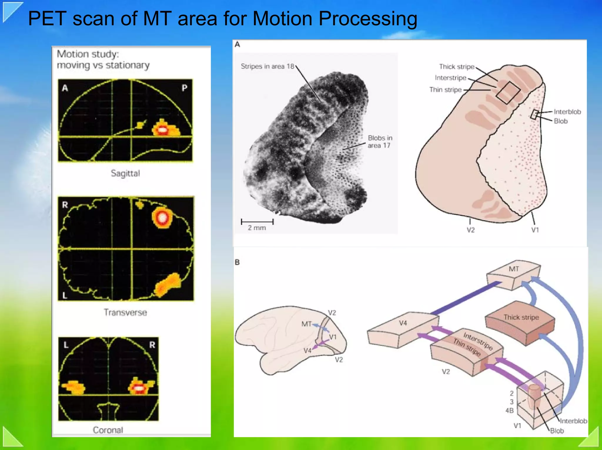PET scan of MT area for Motion Processing
 