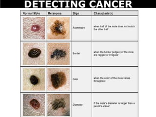 DETECTING CANCER
 
