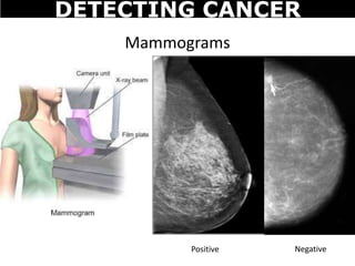 Mammograms
Positive Negative
DETECTING CANCER
 