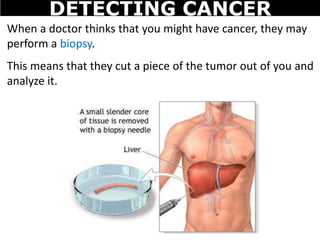 When a doctor thinks that you might have cancer, they may
perform a biopsy.
This means that they cut a piece of the tumor out of you and
analyze it.
DETECTING CANCER
 