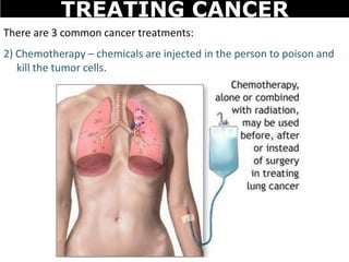 There are 3 common cancer treatments:
2) Chemotherapy – chemicals are injected in the person to poison and
kill the tumor cells.
TREATING CANCER
 