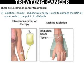 There are 3 common cancer treatments:
3) Radiation Therapy – radioactive energy is used to damage the DNA of
cancer cells to the point of cell death.
TREATING CANCER
 