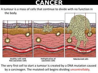 A tumour is a mass of cells that continue to divide with no function in
the body.
The very first cell to start a tumour is created by a DNA mutation caused
by a carcinogen. The mutated cell begins dividing uncontrollably.
CANCER
 