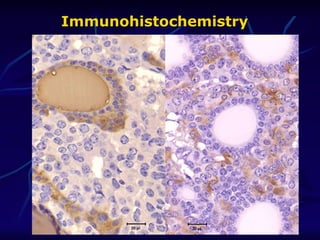 Immunohistochemistry   