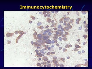 Immunocytochemistry 