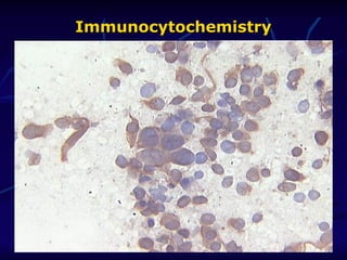 Immunocytochemistry
Immunocytochemistry
 