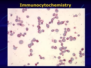 Immunocytochemistry
Immunocytochemistry
 