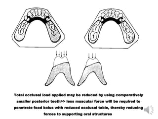Latice Base Rpd Denture bases of RPDs | PPT
