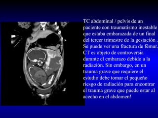 TC abdominal / pelvis de un
paciente con traumatismo inestable
que estaba embarazada de un final
del tercer trimestre de la gestación .
Se puede ver una fractura de fémur.
CT es objeto de controversia
durante el embarazo debido a la
radiación. Sin embargo, en un
trauma grave que requiere el
estudio debe tomar el pequeño
riesgo de radiación para encontrar
el trauma grave que puede estar al
acecho en el abdomen!
 