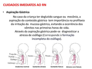 04 enfermagem neonatal avaliacao antropometrica | PPTX