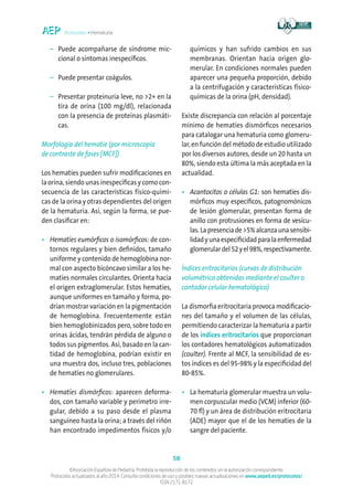 Protocolos • Hematuria
58
©Asociación Española de Pediatría. Prohibida la reproducción de los contenidos sin la autorización correspondiente.
Protocolos actualizados al año 2014. Consulte condiciones de uso y posibles nuevas actualizaciones en www.aeped.es/protocolos/
ISSN 2171-8172
	 –	Puede acompañarse de síndrome mic-
cional o síntomas inespecíficos.
	 –	Puede presentar coágulos.
	 –	Presentar proteinuria leve, no 2+ en la
tira de orina (100 mg/dl), relacionada
con la presencia de proteínas plasmáti-
cas.
Morfología del hematíe (por microscopía
de contraste de fases [MCF])
Los hematíes pueden sufrir modificaciones en
la orina, siendo unas inespecíficas y como con-
secuencia de las características físico-quími-
cas de la orina y otras dependientes del origen
de la hematuria. Así, según la forma, se pue-
den clasificar en:
•	Hematíes eumórficos o isomórficos: de con-
tornos regulares y bien definidos, tamaño
uniforme y contenido de hemoglobina nor-
mal con aspecto bicóncavo similar a los he-
matíes normales circulantes. Orienta hacia
el origen extraglomerular. Estos hematíes,
aunque uniformes en tamaño y forma, po-
drían mostrar variación en la pigmentación
de hemoglobina. Frecuentemente están
bien hemoglobinizados pero, sobre todo en
orinas ácidas, tendrán pérdida de alguno o
todos sus pigmentos. Así, basado en la can-
tidad de hemoglobina, podrían existir en
una muestra dos, incluso tres, poblaciones
de hematíes no glomerulares.
•	Hematíes dismórficos: aparecen deforma-
dos, con tamaño variable y perímetro irre-
gular, debido a su paso desde el plasma
sanguíneo hasta la orina; a través del riñón
han encontrado impedimentos físicos y/o
químicos y han sufrido cambios en sus
membranas. Orientan hacia origen glo-
merular. En condiciones normales pueden
aparecer una pequeña proporción, debido
a la centrifugación y características físico-
químicas de la orina (pH, densidad).
Existe discrepancia con relación al porcentaje
mínimo de hematíes dismórficos necesarios
para catalogar una hematuria como glomeru-
lar, en función del método de estudio utilizado
por los diversos autores, desde un 20 hasta un
80%, siendo esta última la más aceptada en la
actualidad.
•	Acantocitos o células G1: son hematíes dis-
mórficos muy específicos, patognomónicos
de lesión glomerular, presentan forma de
anillo con protrusiones en forma de vesícu-
las.Lapresenciade5%alcanzaunasensibi-
lidadyunaespecificidadparalaenfermedad
glomerulardel52yel98%,respectivamente.
Índices eritrocitarios (curvas de distribución
volumétrica obtenidas mediante el coulter o
contador celular hematológico)
La dismorfia eritrocitaria provoca modificacio-
nes del tamaño y el volumen de las células,
permitiendo caracterizar la hematuria a partir
de los índices eritrocitarios que proporcionan
los contadores hematológicos automatizados
(coulter). Frente al MCF, la sensibilidad de es-
tos índices es del 95-98% y la especificidad del
80-85%.
•	La hematuria glomerular muestra un volu-
men corpuscular medio (VCM) inferior (60-
70 fl) y un área de distribución eritrocitaria
(ADE) mayor que el de los hematíes de la
sangre del paciente.
 
