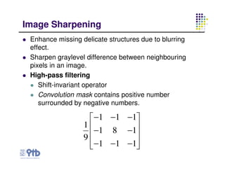04 image enhancement edge detection | PDF