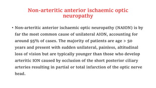Non-arteritic anterior ischaemic optic
neuropathy
• Non-arteritic anterior ischaemic optic neuropathy (NAION) is by
far the most common cause of unilateral AION, accounting for
around 95% of cases. The majority of patients are age > 50
years and present with sudden unilateral, painless, altitudinal
loss of vision but are typically younger than those who develop
arteritic ION caused by occlusion of the short posterior ciliary
arteries resulting in partial or total infarction of the optic nerve
head.
 