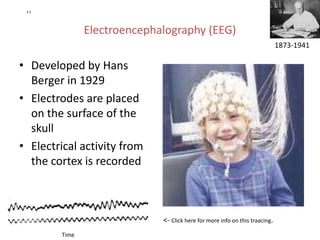 2.5




               Electroencephalography (EEG)
                                                                             1873-1941

• Developed by Hans
  Berger in 1929
• Electrodes are placed
  on the surface of the
  skull
• Electrical activity from
  the cortex is recorded



                             <- Click here for more info on this traacing.
        Time
 
