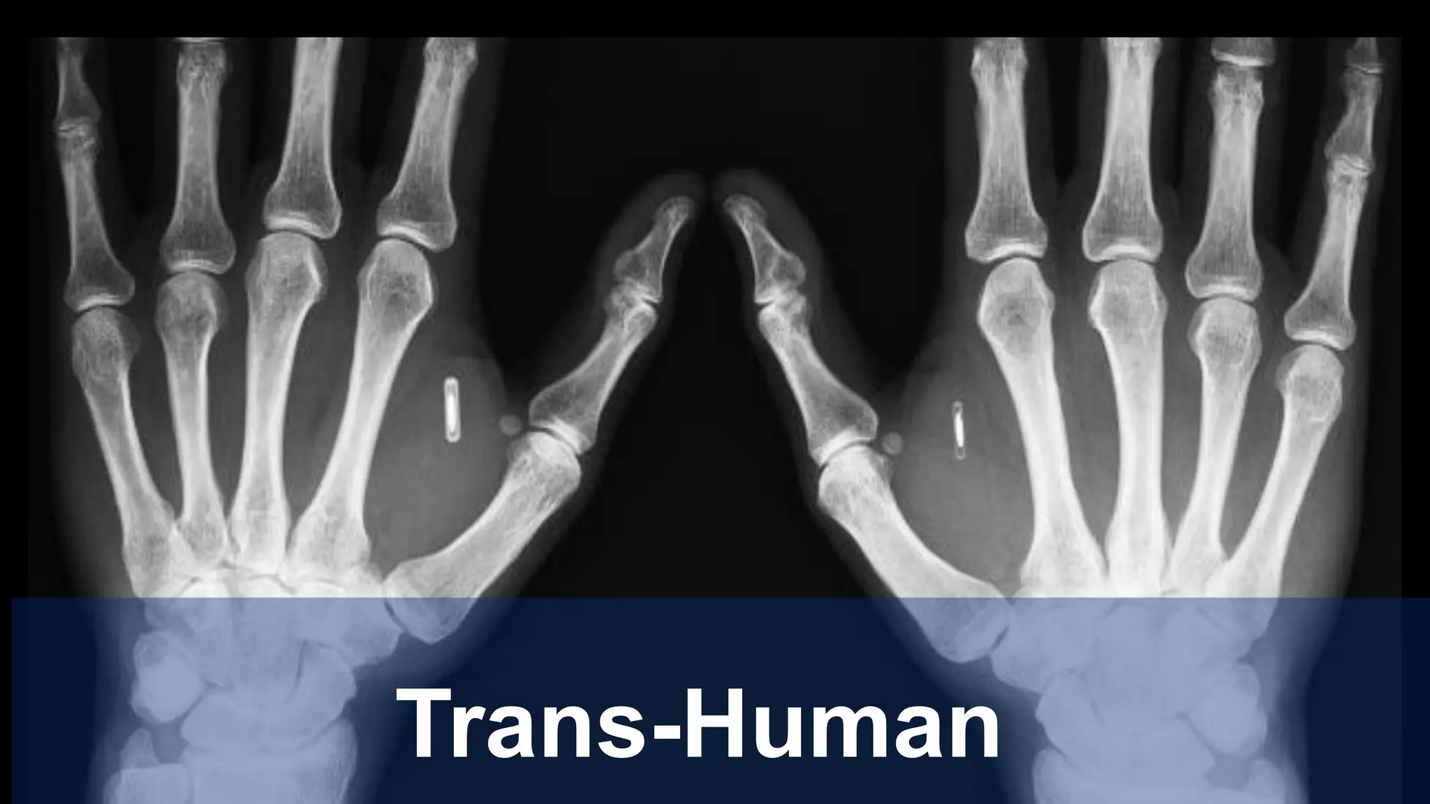 Trans-Human
 