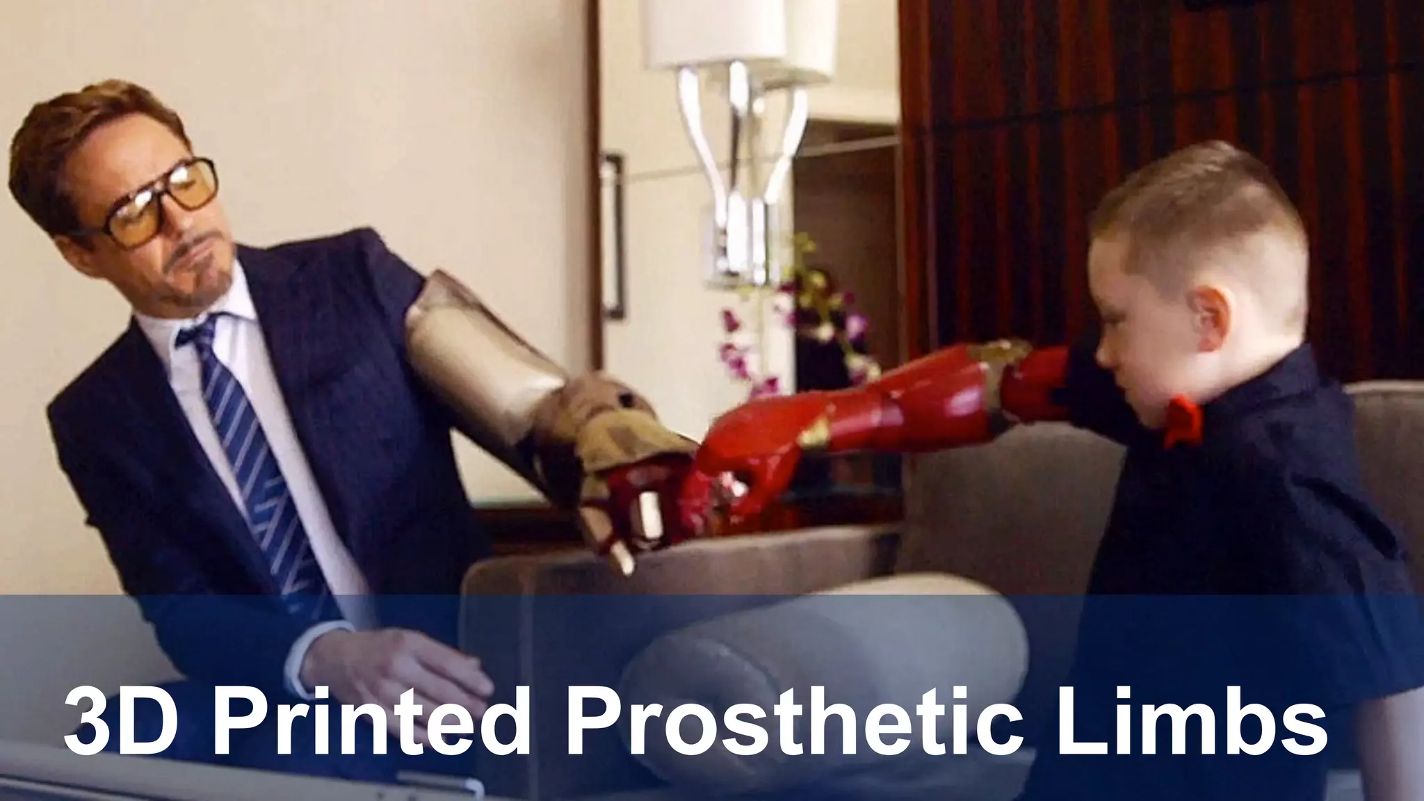 3D Printed Prosthetic Limbs
 