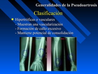 how to change screen time passcode on iphone without old password