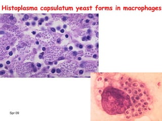 Spr 09 17
Histoplasma capsulatum yeast forms in macrophages
 