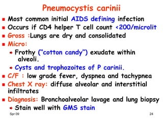 Spr 09 24
Pneumocystis carinii
Most common initial AIDS defining infection
Occurs if CD4 helper T cell count <200/microlit
Gross :Lungs are dry and consolidated
Micro:
Frothy (“cotton candy”) exudate within
alveoli.
Cysts and trophozoites of P carinii.
C/F : low grade fever, dyspnea and tachypnea
Chest X ray: diffuse alveolar and interstitial
infiltrates
Diagnosis: Bronchoalveolar lavage and lung biopsy
Stain well with GMS stain
 