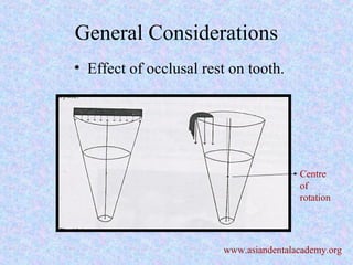 General Considerations
• Effect of occlusal rest on tooth.
Centre
of
rotation
www.asiandentalacademy.org
 