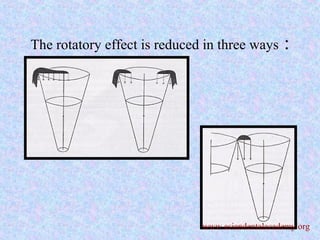 The rotatory effect is reduced in three ways :
www.asiandentalacademy.org
 
