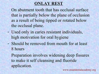 ONLAY REST
On abutment tooth that has occlusal surface
that is partially below the plane of occlusion
as a result of being tipped or rotated below
the occlusal plane.
- Used only in caries resistant individuals,
high motivation for oral hygiene
- Should be removed from mouth for at least
8 hours
Preparation involves widening deep fissures
to make it self cleansing and fluoride
application.
www.asiandentalacademy.org
 