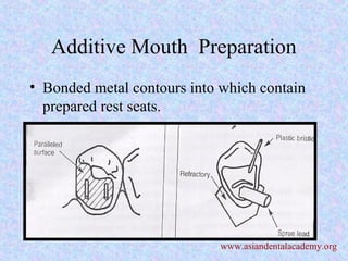 Additive Mouth Preparation
• Bonded metal contours into which contain
prepared rest seats.
www.asiandentalacademy.org
 