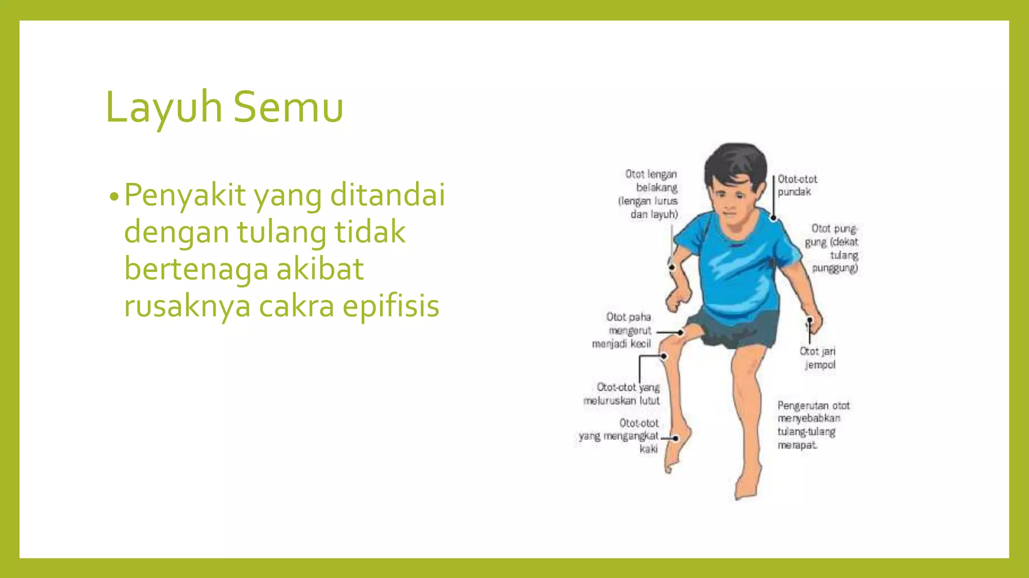Layuh 04 sistem gerak pada manusia gangguan | PPTX