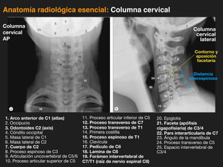 iDESIGN
by HiSlide.io
Anatomía radiológica esencial: Columna cervical
1. Arco anterior de C1 (atlas)
2. Occipucio
3. Odontoides C2 (axis)
4. Cóndilo occipital
5. Masa lateral de C1
6. Masa lateral de C2
7. Cuerpo de C2
8. Proceso espinoso de C3
9. Articulación uncovertebral de C5/6
10. Proceso articular superior de C5
11. Proceso articular inferior de C5
12. Proceso transverso de C7
13. Proceso transverso de T1
14. Primera costilla
15. Proceso espinoso de T1
16. Clavícula
17. Pedículo de C6
18. Lamina de C6
19. Forámen intervertebral de
C7/T1 (raíz de nervio espinal C8)
20. Epiglotis
21. Faceta (apófisis
cigapofisiaria) de C3/4
22. Pars interarticularis de C7
23. Ángulo de la mandíbula
24. Proceso transverso de C5
25. Espacio intervertebral de
C3/4
Contorno y
aposición
facetaria
Distancia
interespinosa
Columna
cervical
AP
Columna
cervical
lateral
 