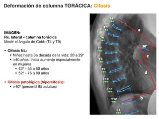 Deformación de columna TORÁCICA: Cifosis
IMAGEN:
Rx. lateral - columna torácica
Medir el ángulo de Cobb (T4 y T9)
• Cifosis NL:
• Niñez hasta 3a década de la vida: 20 a 29º
• 40 años: Inicia aumento especialmente
en mujeres
• 43º - 55 a 60 años
• 52º - 76 a 80 años
• Cifosis patológica (hipercifosis):
• 40º (percentil 95 adultos)
 