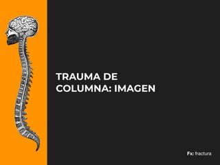 iDESIGN
by HiSlide.io
TRAUMA DE
COLUMNA: IMAGEN
Fx: fractura
 