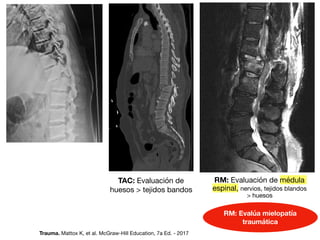 TAC: Evaluación de
huesos  tejidos bandos
RM: Evaluación de médula
espinal, nervios, tejidos blandos
 huesos
RM: Evalúa mielopatía
traumática
Trauma. Mattox K, et al. McGraw-Hill Education, 7a Ed. - 2017
 