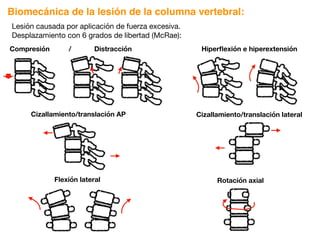 Compresión / Distracción
Rotación axial
Biomecánica de la lesión de la columna vertebral:
Lesión causada por aplicación de fuerza excesiva.
Desplazamiento con 6 grados de libertad (McRae):
Cizallamiento/translación AP Cizallamiento/translación lateral
Flexión lateral
Hiperflexión e hiperextensión
 