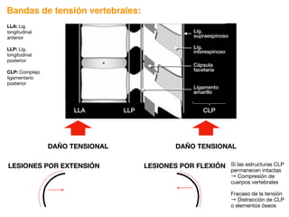 Bandas de tensión vertebrales:
LLA LLP CLP
Lig.
supraespinoso
Lig.
interespinoso
Cápsula
facetaria
Ligamento
amarillo
LESIONES POR FLEXIÓN
LESIONES POR EXTENSIÓN
DAÑO TENSIONAL
DAÑO TENSIONAL
Si las estructuras CLP
permanecen intactas
→ Compresión de
cuerpos vertebrales
Fracaso de la tensión
→ Distracción de CLP
o elementos óseos
LLA: Lig.
longitudinal
anterior
LLP: Lig.
longitudinal
posterior
CLP: Complejo
ligamentario
posterior
 