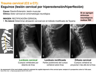 Si se agregan
síntomas
neurológicos
realizar RM
Trauma cervical (C2 a C7):
Esguince (lesión cervical por hiperextensión/hiperflexión)
An assessment of the most reliable method to estimate the sagittal alignment of the cervical spine: analysis of a prospective cohort of 138 cases.
Donk RD, et al. J Neurosurg Spine 26:572–576, 2017
Causa: Flexión/Extensión, lesión muscular
Clínica: Dolor cervical sin sintomatología neurológica
IMAGEN: RECTIFICACIÓN CERVICAL
• Rx lateral: Determinar alineación cervical con el método modificado de Toyama
Lordosis cervical
Cuerpos vertebrales por
delante de línea
Lordosis rectificada
Partes posteriores del cuerpo
vertebral sobre línea
Cifosis cervical
Cuerpos vertebral se
proyectan más allá de la línea
 
