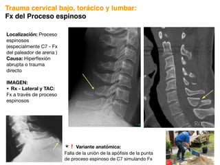 Localización: Proceso
espinosos
(especialmente C7 - Fx
del paleador de arena )
Causa: Hiperflexión
abrupta o trauma
directo
IMAGEN:
• Rx - Lateral y TAC:
Fx a través de proceso
espinosos
!❗ Variante anatómica:
Falla de la unión de la apófisis de la punta
de proceso espinoso de C7 simulando Fx
NE
Trauma cervical bajo, torácico y lumbar:
Fx del Proceso espinoso
 