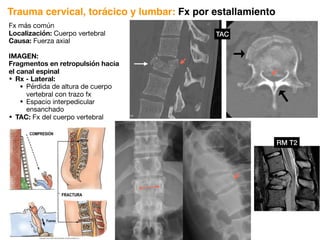Fx más común
Localización: Cuerpo vertebral
Causa: Fuerza axial
IMAGEN:
Fragmentos en retropulsión hacia
el canal espinal
• Rx - Lateral:
• Pérdida de altura de cuerpo
vertebral con trazo fx
• Espacio interpedicular
ensanchado
• TAC: Fx del cuerpo vertebral
Trauma cervical, torácico y lumbar: Fx por estallamiento
TAC
RM T2
 