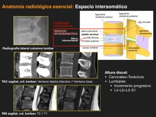 iDESIGN
by HiSlide.io
Anatomía radiológica esencial: Espacio intersomático
platillo terminal
anillo fibroso
ligamento
vertebral anterior
ligamento
vertebral posterior
ESPACIO
INTERSOMÁTICO
núcleo pulposo
I.III.1. Galería de imágenes por RM de cambios degenerativos
a) b)
a) b)
ía de imágenes por RM de cambios degenerativos
b)
a) b)
Disco
intervertebral
Radiografía lateral columna lumbar
TAC sagital, col. lumbar: Ventana tejidos blandos // Ventana ósea
RM sagital, col. lumbar: T2 // T1
COMPLEJO
OSTEODISCAL
Altura discal:
• CervicalesTorácicos
• Lumbares:
• Incremento progresivo
• L4-L5L5-S1
 