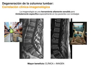 Degeneración de la columna lumbar:
Correlación clínica-imagenológica
La imagenología es una herramienta altamente sensible pero
limitadamente específica especialmente en los pacientes con lumbalgia
Mayor beneficio: CLÍNICA  IMAGEN
 